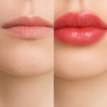 입술 필러 후기