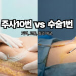 지방흡입-지방분해주사-비교