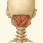 occipital-headache-hospital